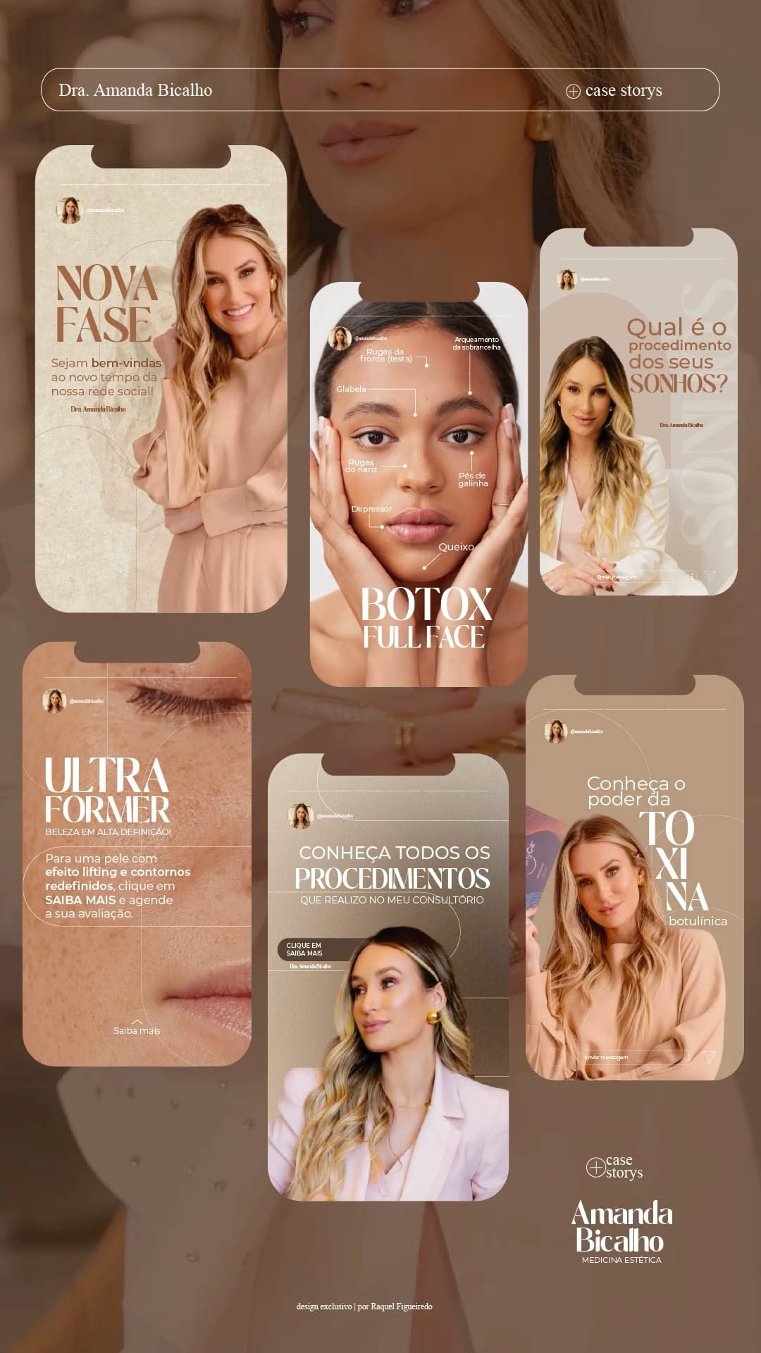 Branding | Instagram storys